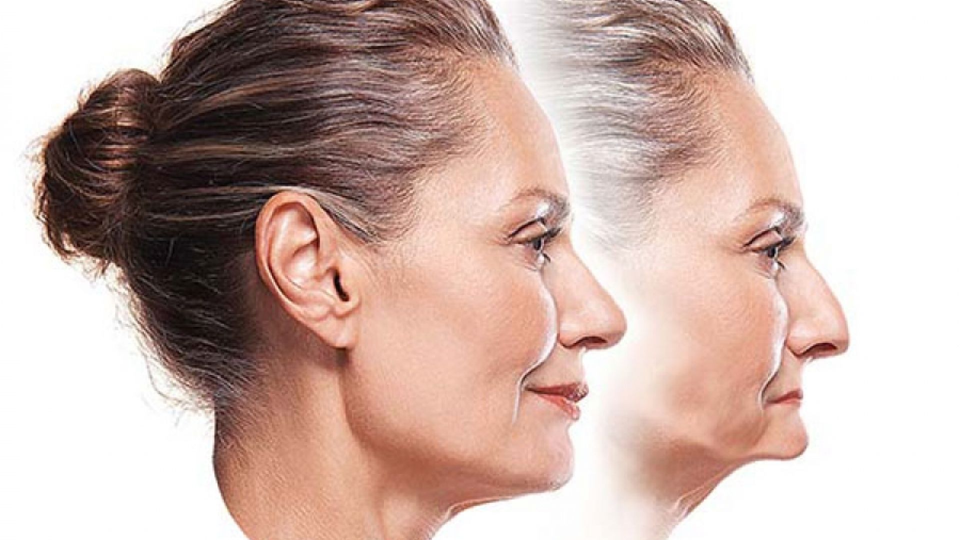 Same woman shown younger and older for aging comparison